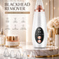 blackhead remover